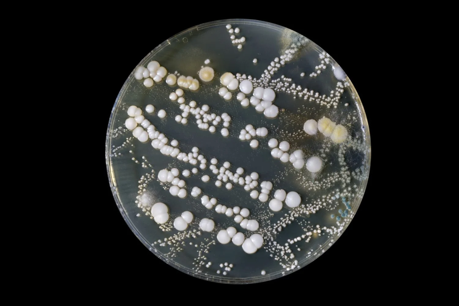 READ: Microbiology: Control of Microbial Growth