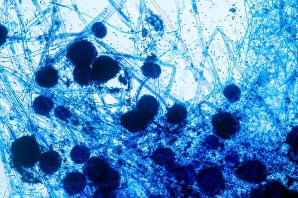 READ: Active Surveillance for Invasive Mold Disease