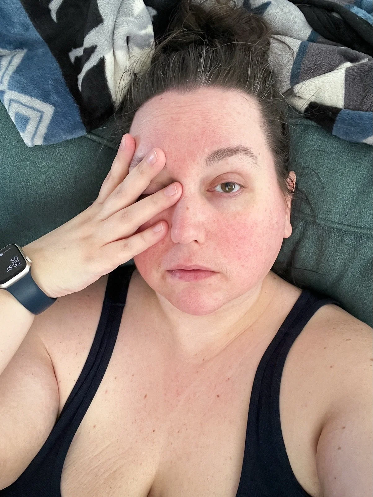 Stretch marks. White hair. Rosacea. These aren&rsquo;t flaws, they&rsquo;re reality. And in a time where we are increasingly wondering &ldquo;is that AI?&rdquo; showing the things that make me human are so much more important than being picture perfe