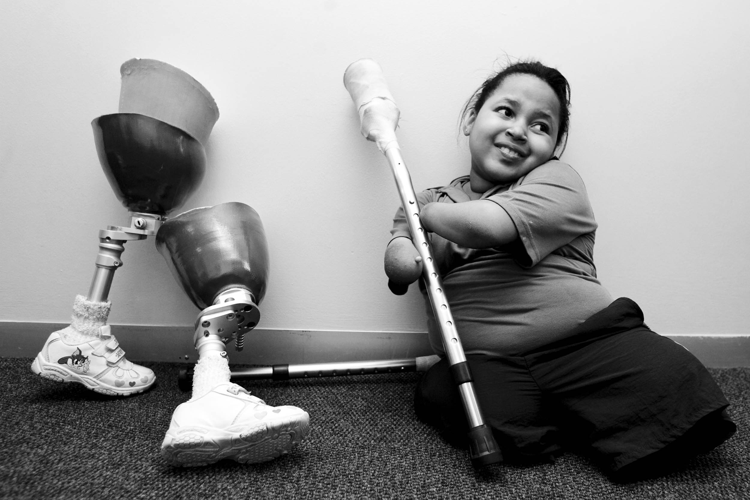  IceXpress outreach program for amputees&nbsp; 