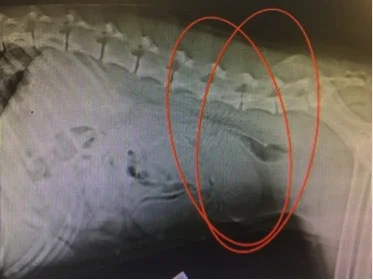 Dilated uterine horn