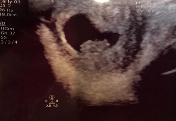 XXXTentacion's mother reveals he has a baby on way 