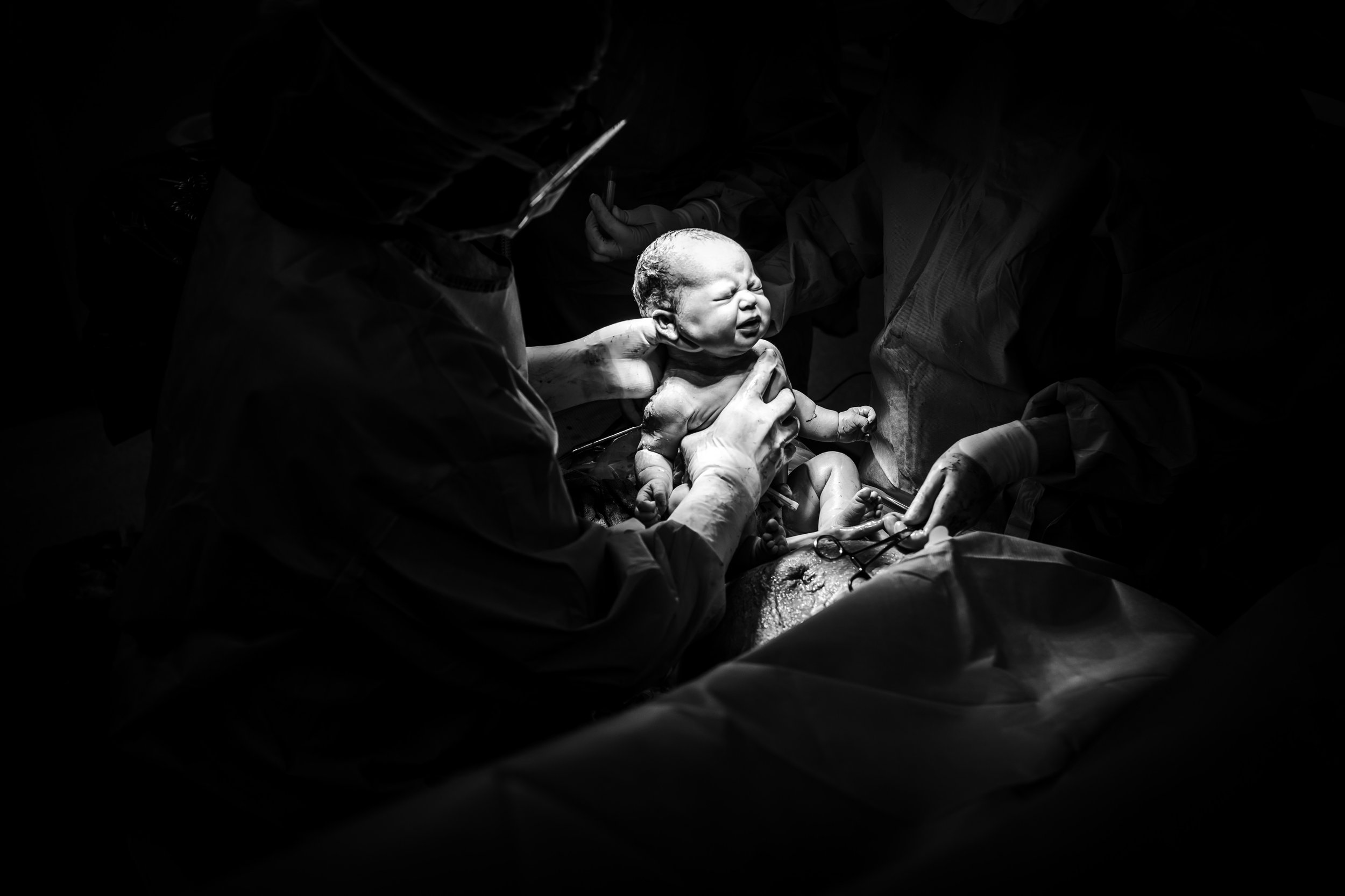 baby is lifted toward light during cesarean birth in Dallas Operating Room