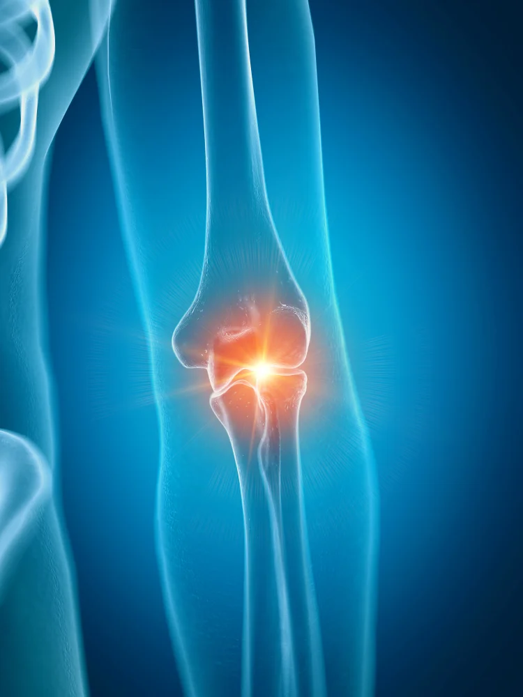Knee_21.jpg