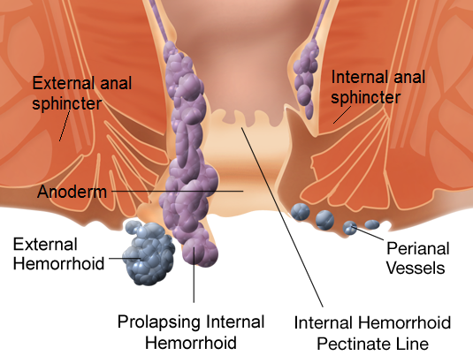 Anal treatment procedure