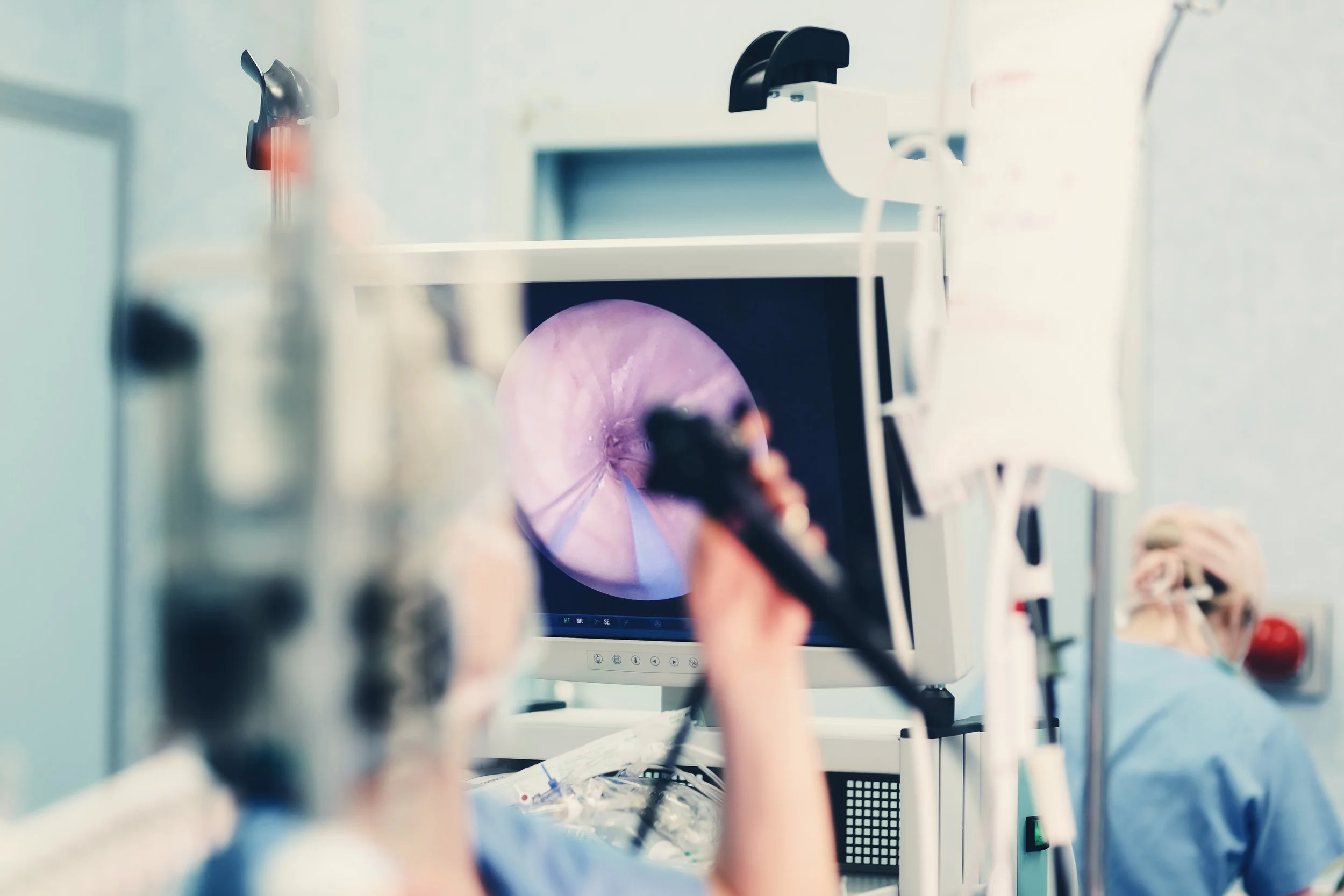 Screening for Colon Cancer: The Classic Colonoscopy