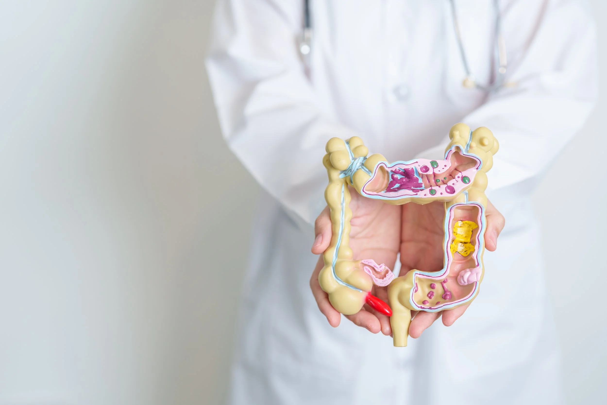 Colorectal Polyps: Should You Be Concerned?