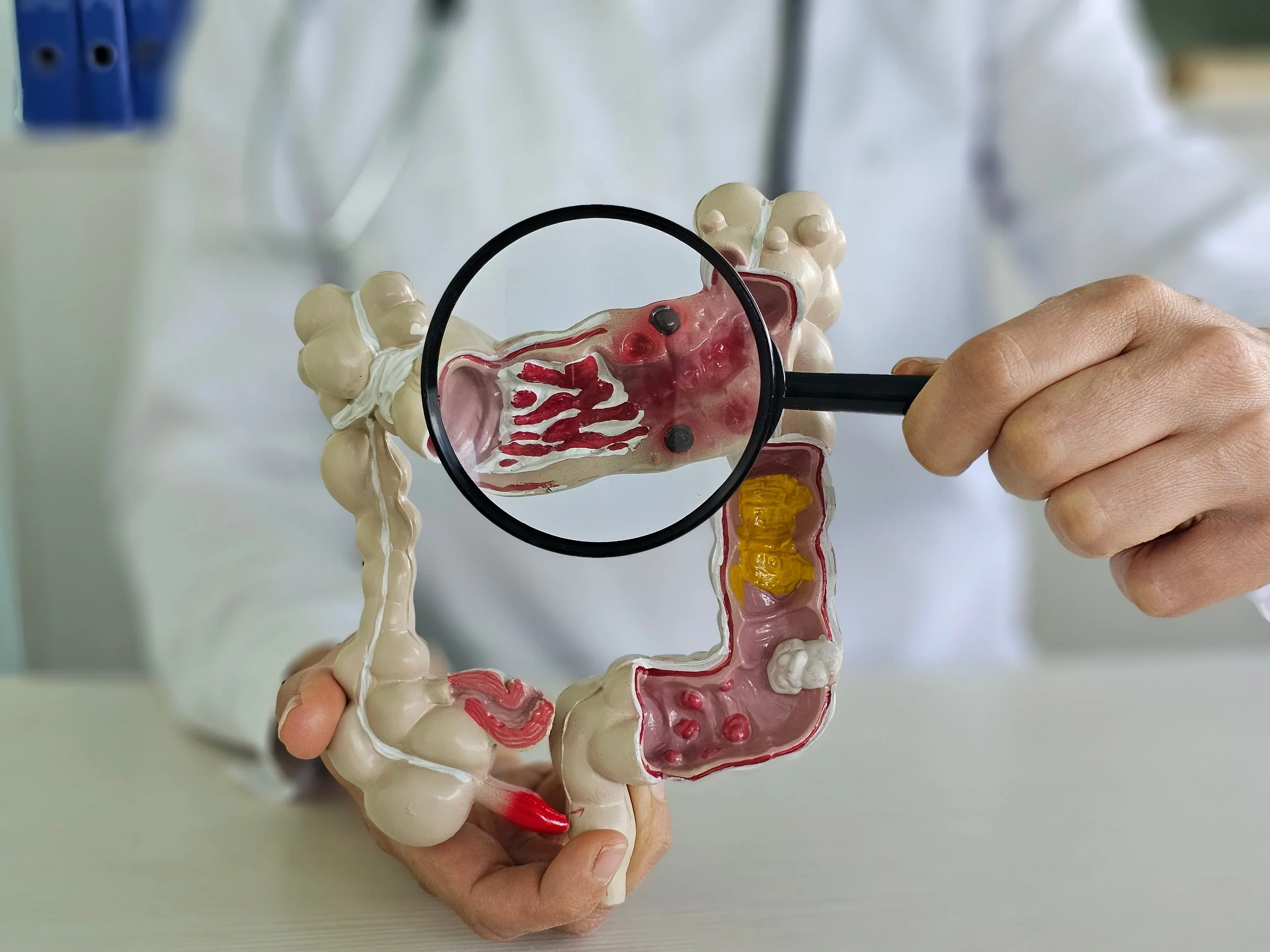 Exploring Minimally Invasive Surgery for Colorectal Conditions