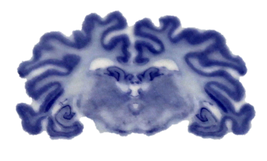 Scientific Publications — Lambert Behavioral Neuroscience Laboratory