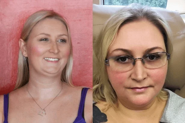 Shelley before her cancer and during her treatment