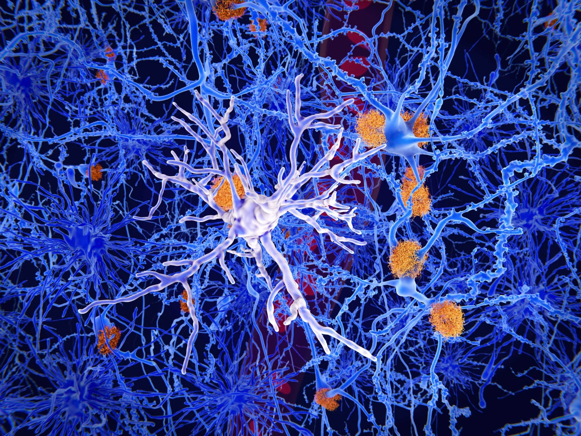 An illustration of neural network cells with blue neural fibers and orange clusters of nerve cell bodies.