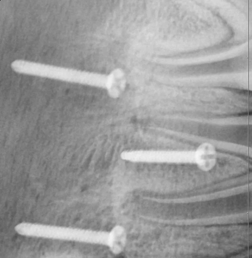 Pig Dental Implant Model — Bridge PTS