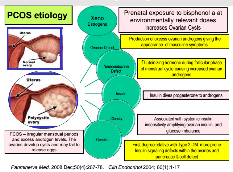 Ovaires polykystiques et syndrome des ovaires polykystiques - Pourquoi  différencier les deux ?