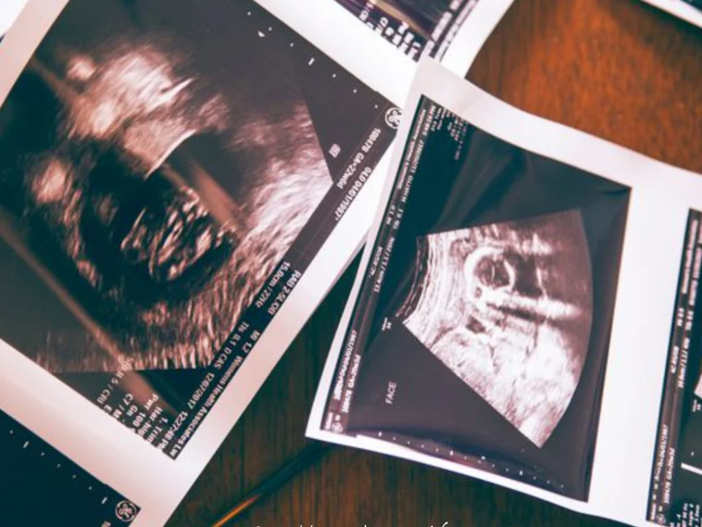 The Face That Changes Everything