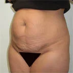 5' 4" 160 lbs.
