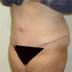 7 lbs. removed