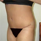 2 lbs. removed