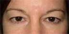 Brow 2a.jpg