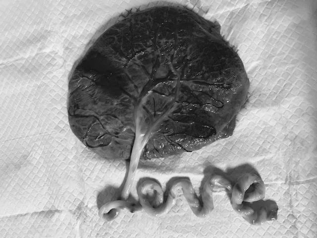 Placenta_Love.jpg