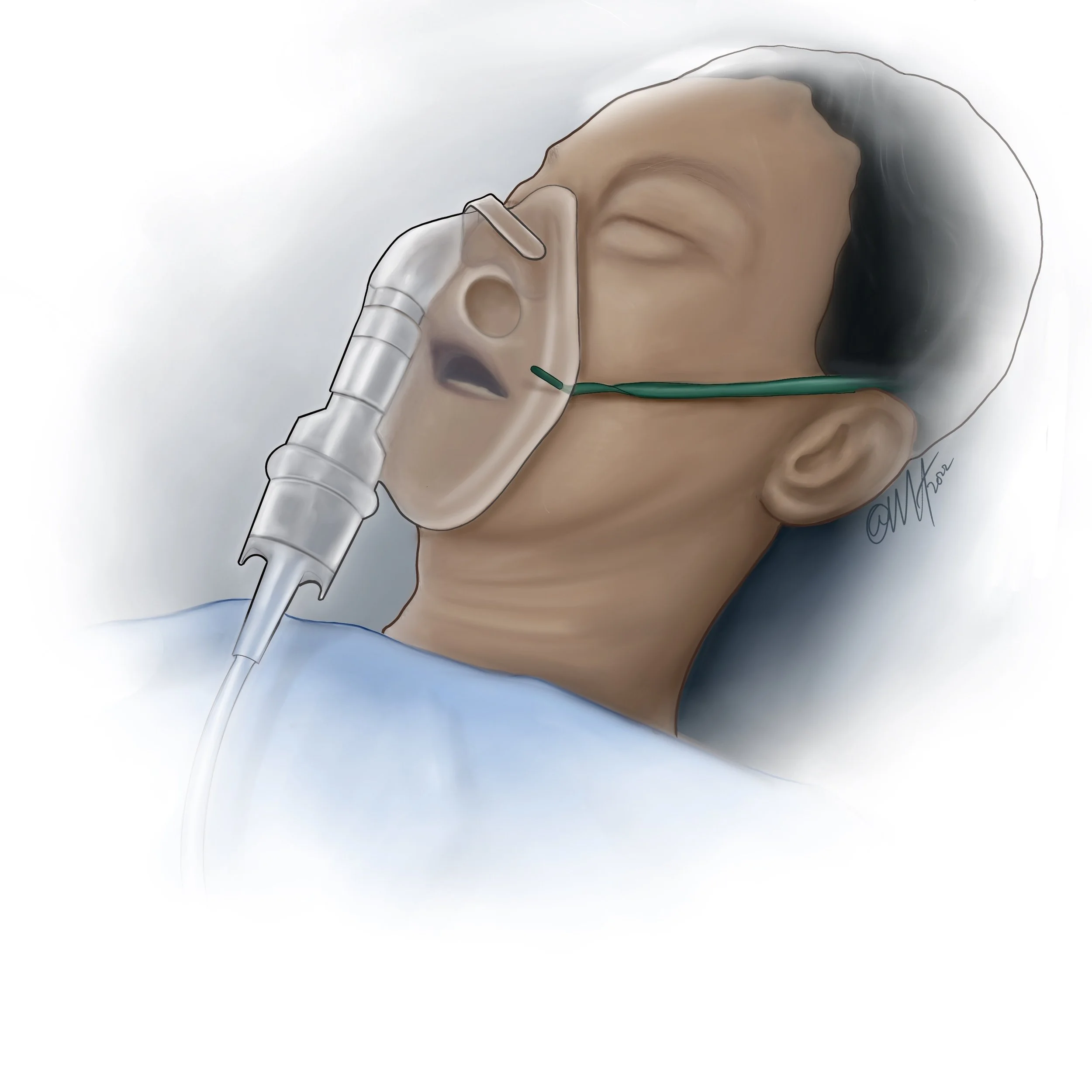Oxygen Mask