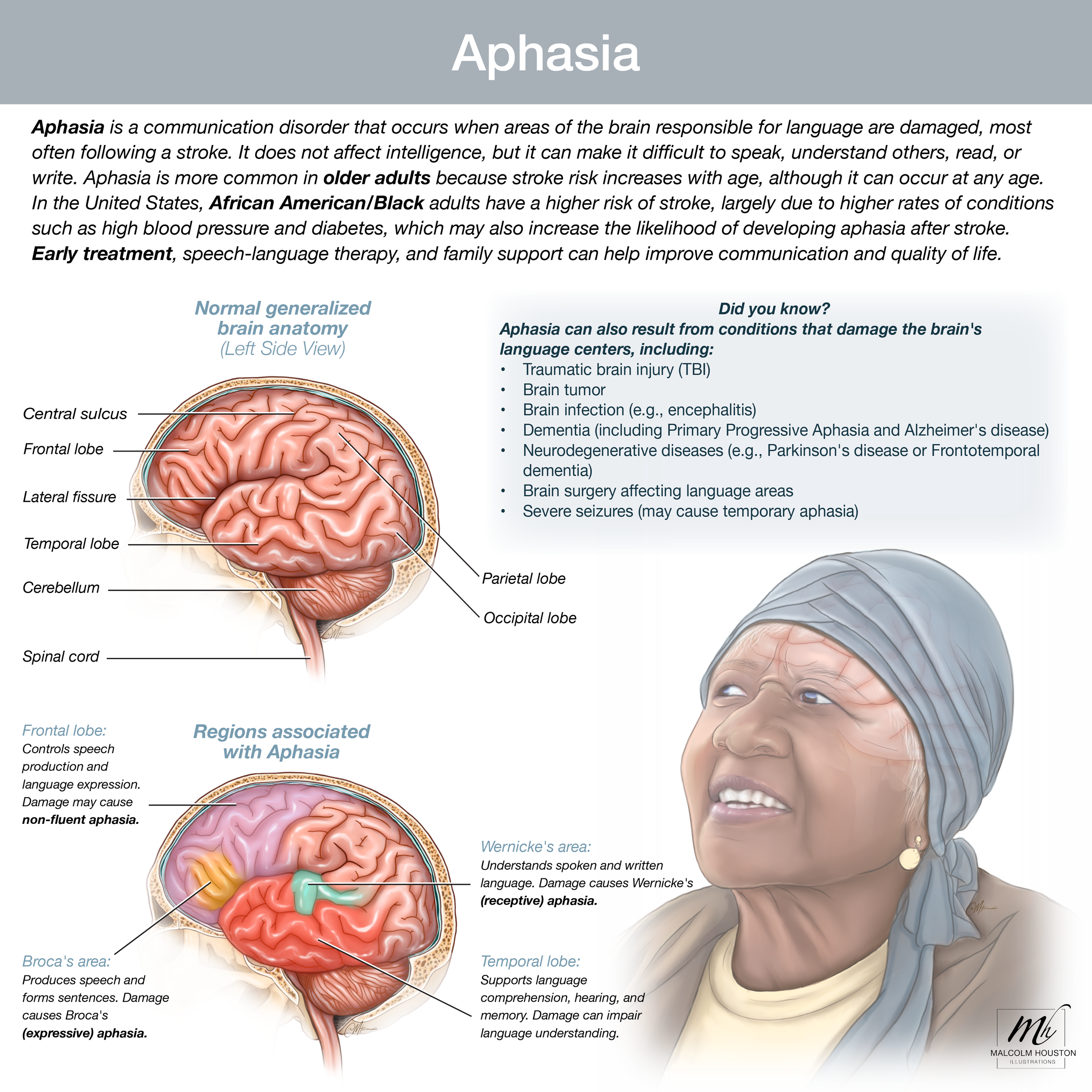 Aphasia