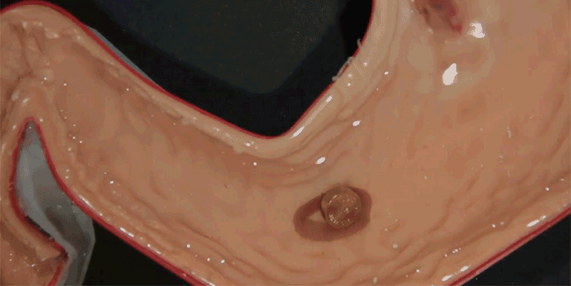 Tiny robot you can swallow