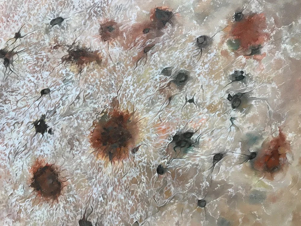 Neurofibrillary Tangles (2019)