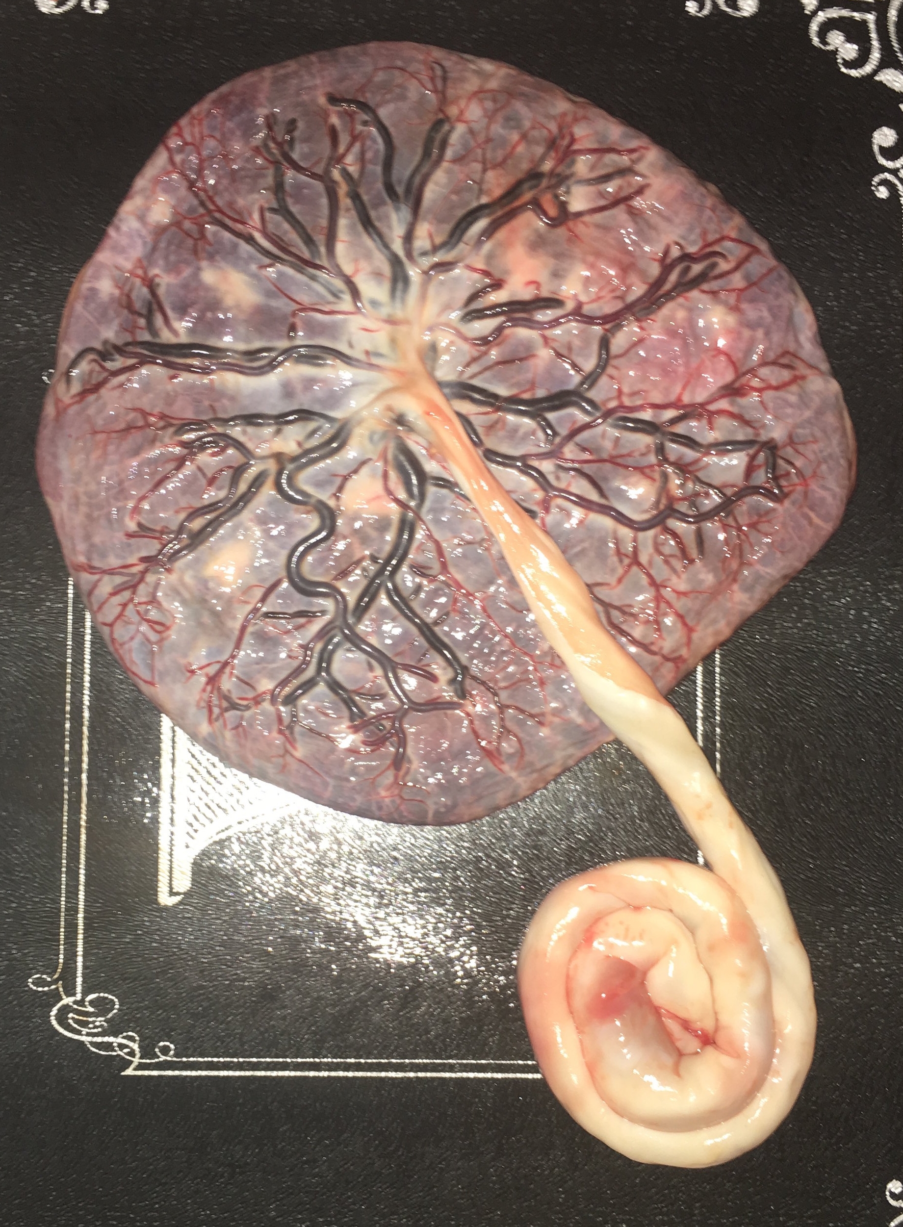 alkhemi's placenta.JPG