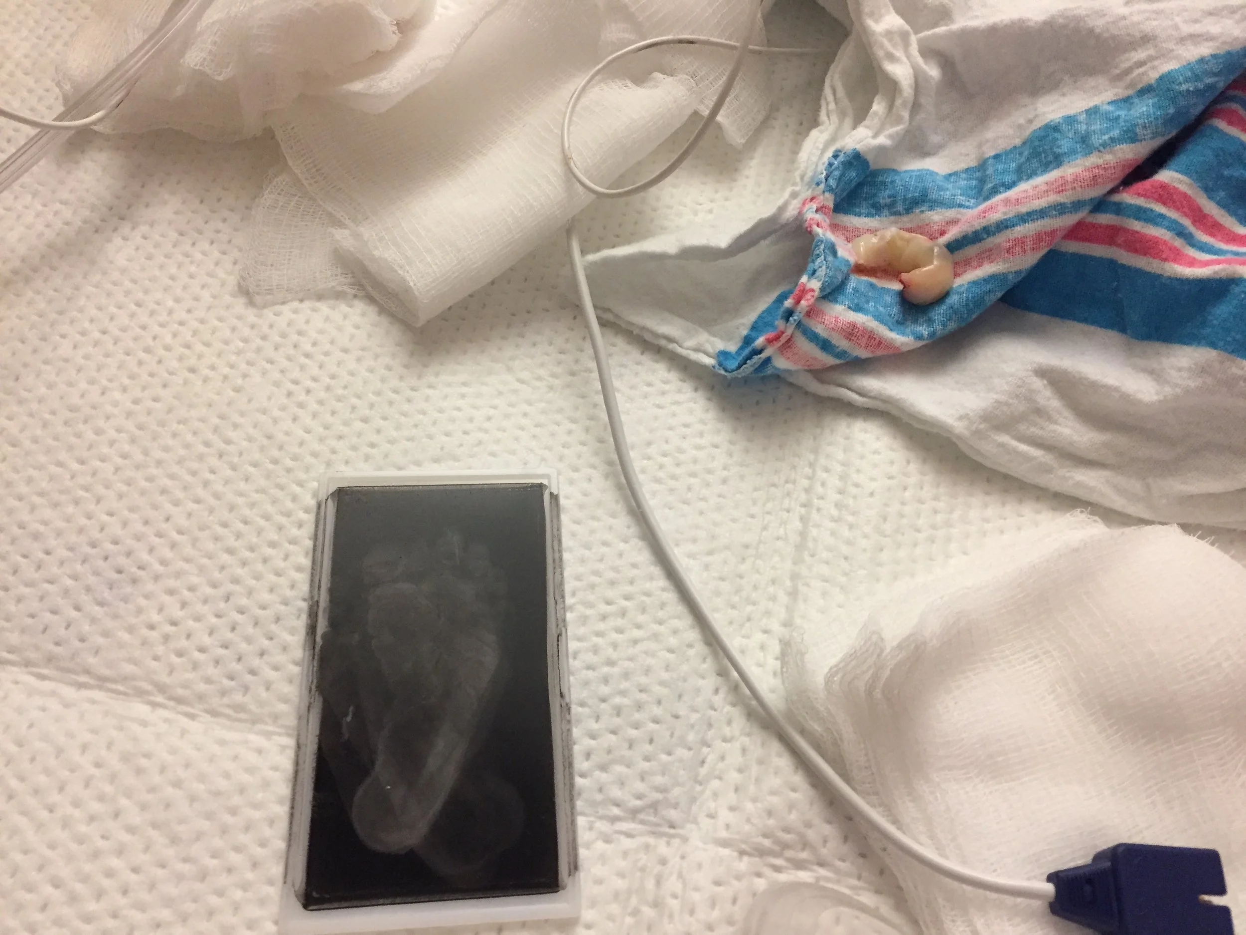 I'll take the epidural instead: My first birth experience