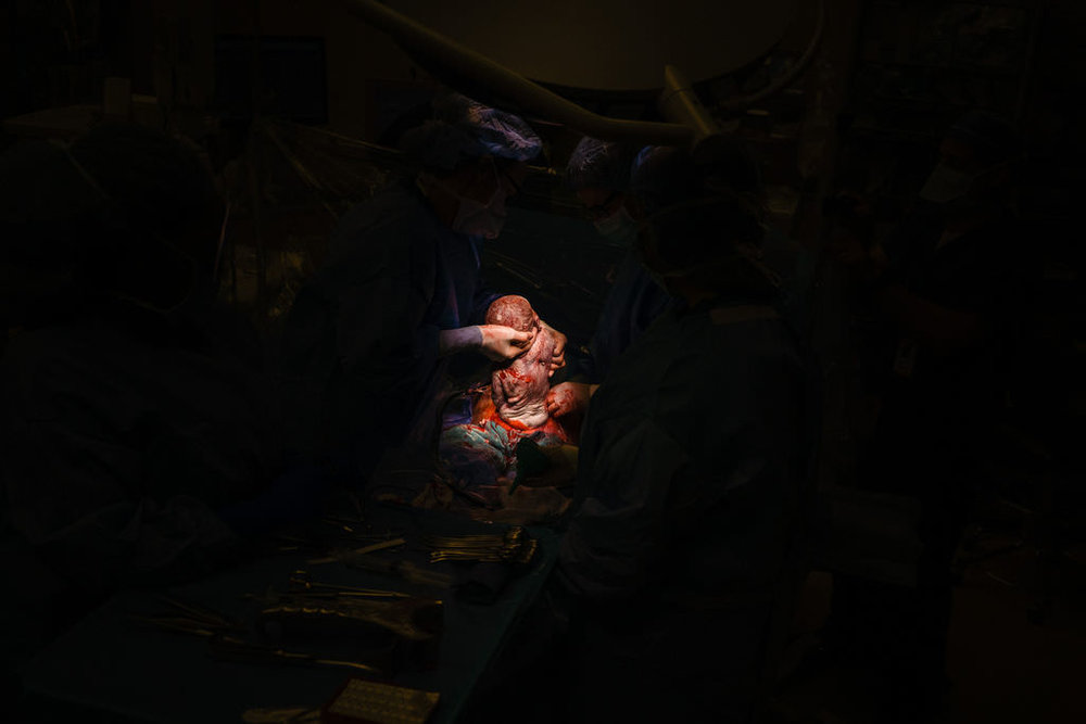 birth-photography-by-c-section-birmingham-al-09.JPG