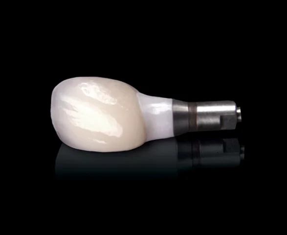 IMPLANT RESTORATIONS