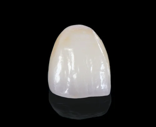 Fixed restorations comprised of, but not limited to, alloy, porcelain, resin, or zirconia are warranted for 5 years* from the date of manufacture. New requests for feldspathic veneers will no longer be warranted.