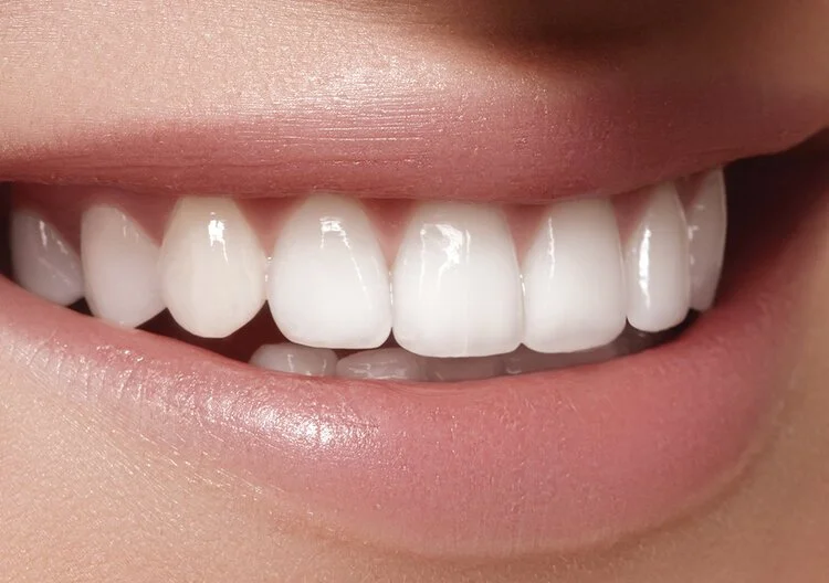 Rekindling your Passion for Cosmetic Dentistry