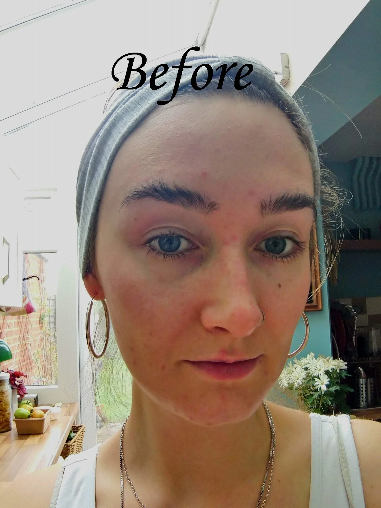 Red, spotty, uneven toned skin