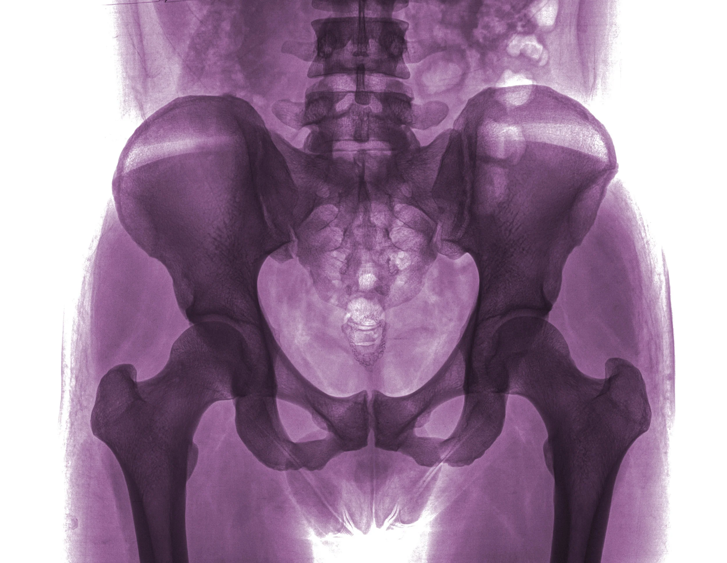 WOMEN'S HEALTH PHYSIOTHERAPY Q & A with Jillian Palmer, PT, CAFCI