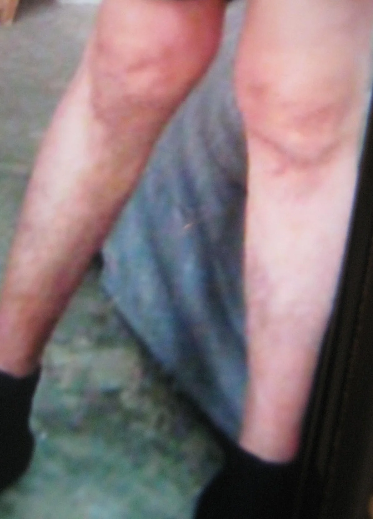 used+on+site-+alzheimers.jpg