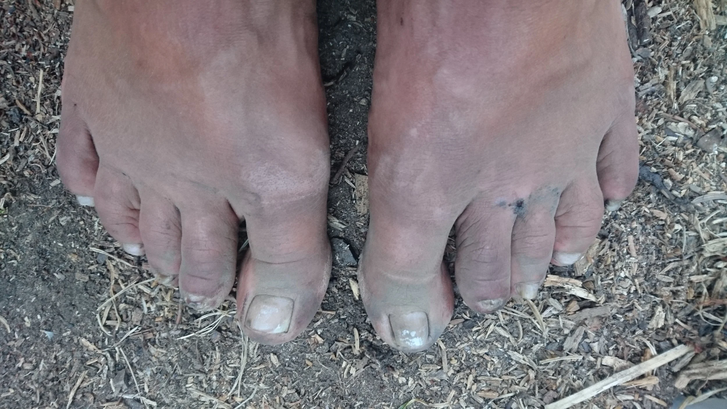 Feet after a long hikingday; kinda grimy.. 