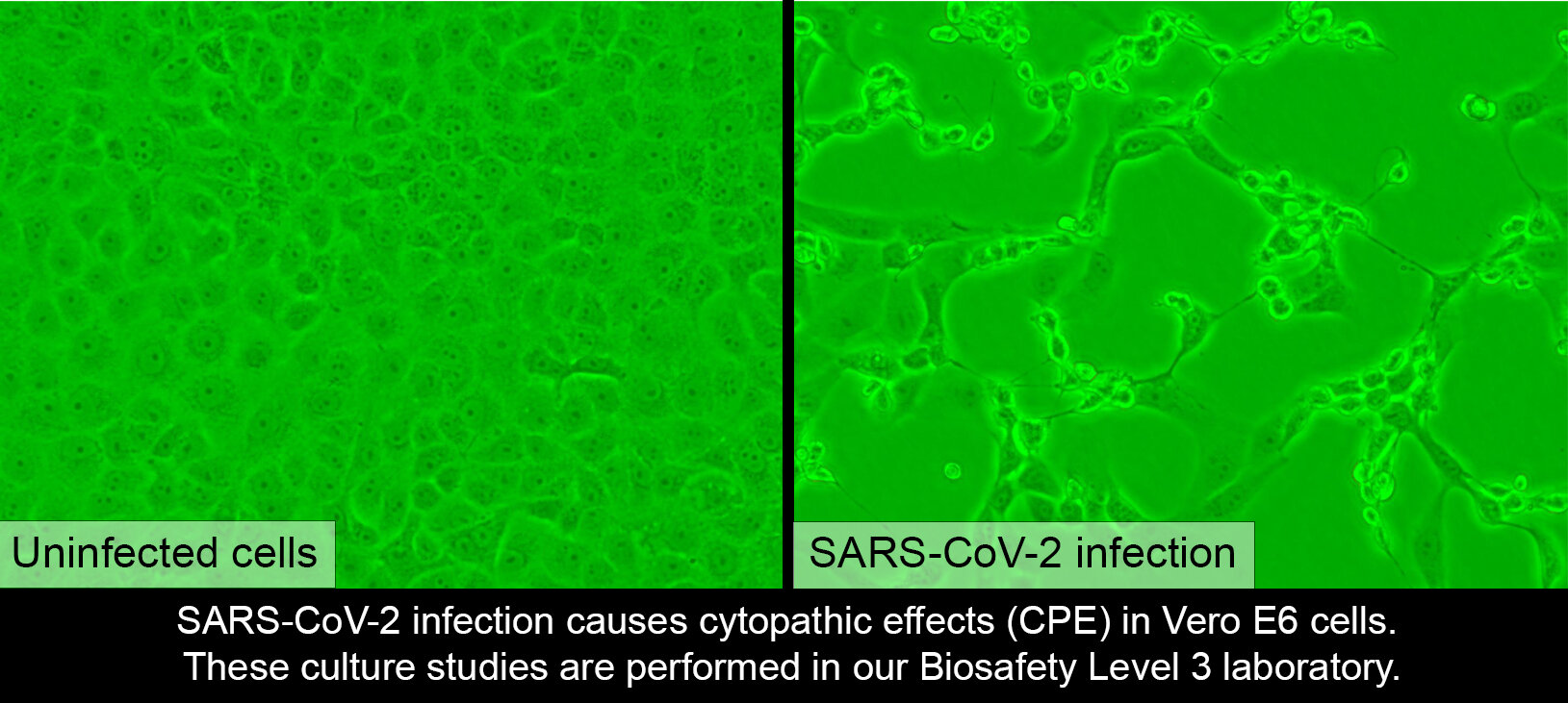 SARS-CoV-2 BSL3 Infection.jpg