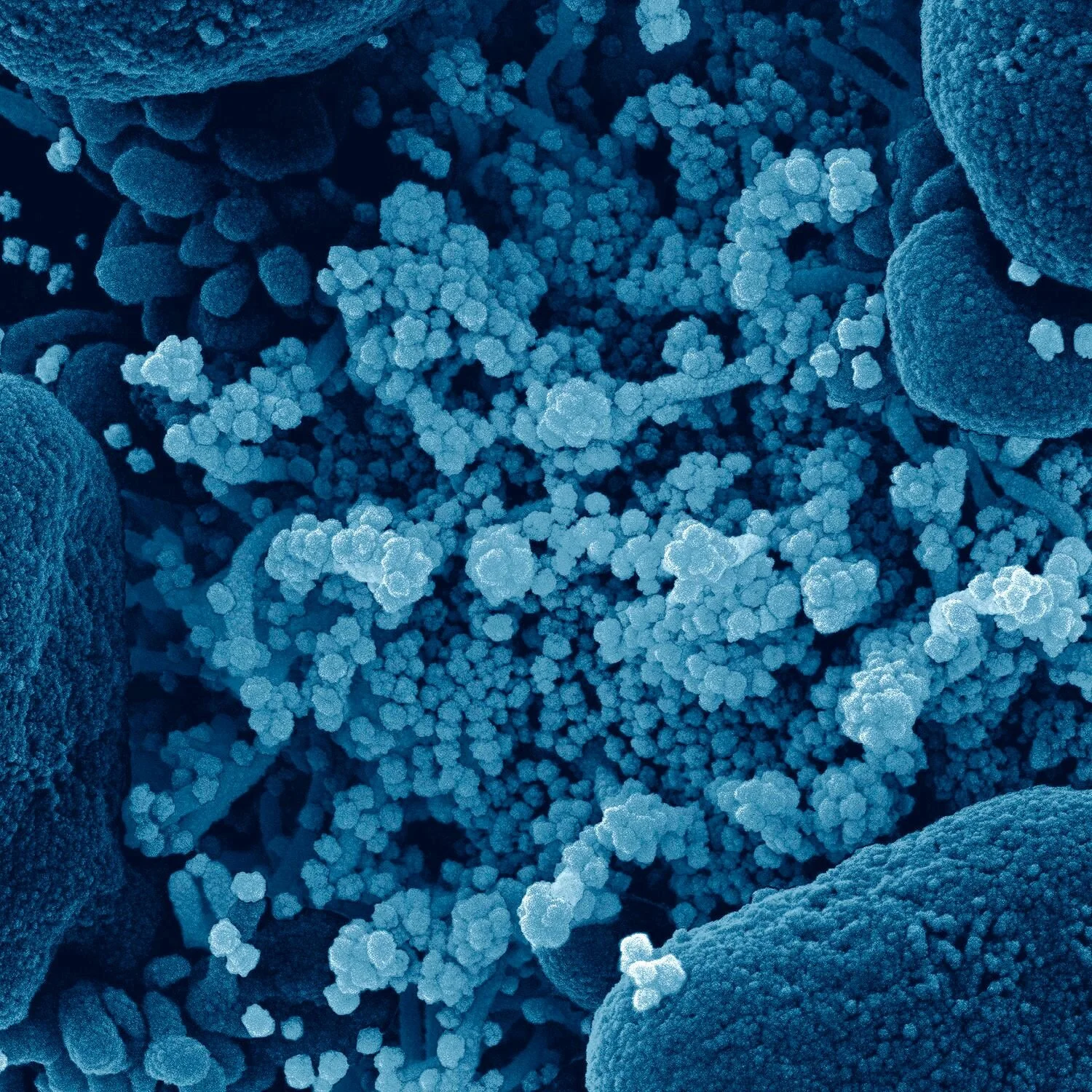 Coronavirus