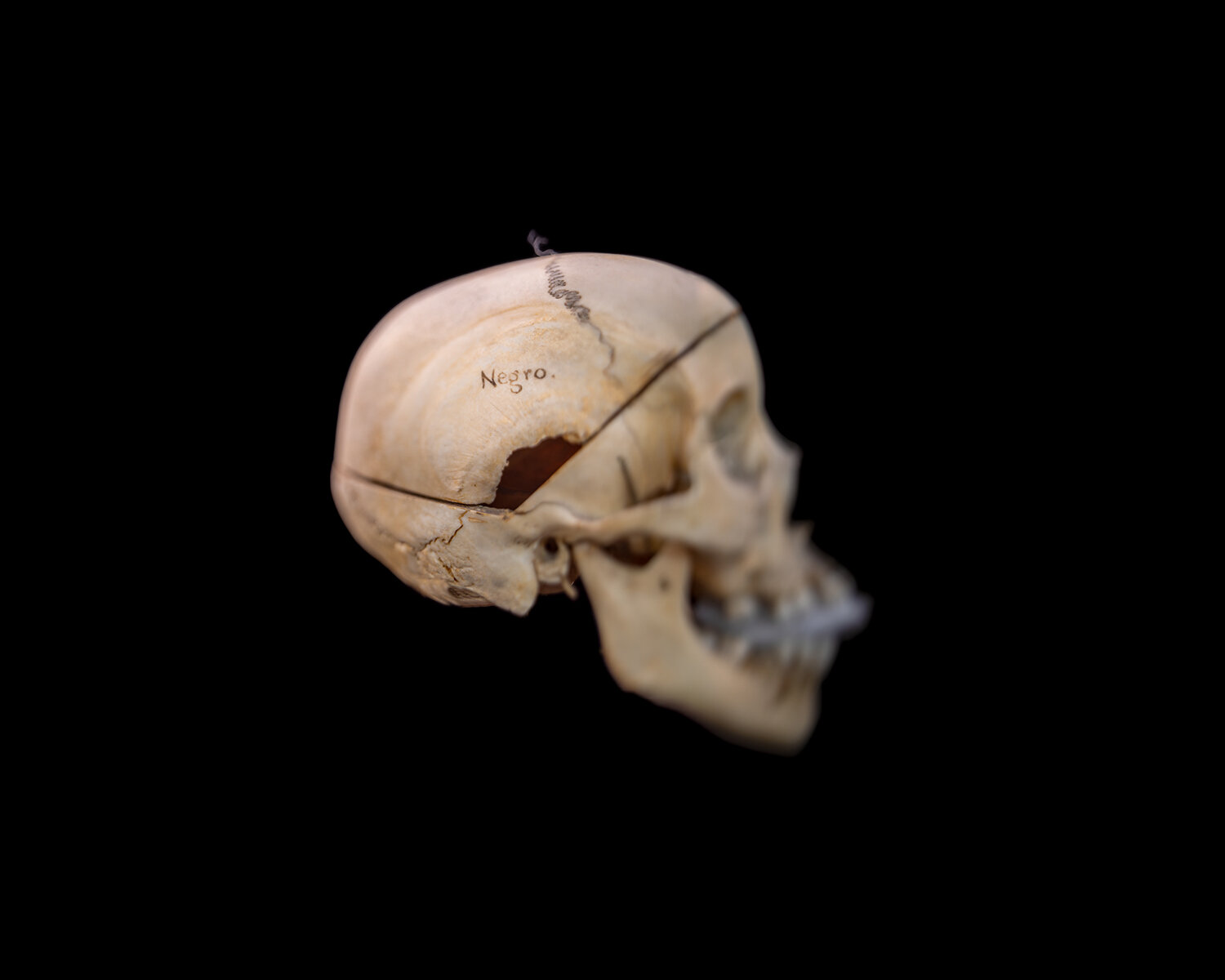  Wendel White,  Skull Inscribed “Negro,” Mütter Museum of the College of Physicians Philadelphia , 2019 