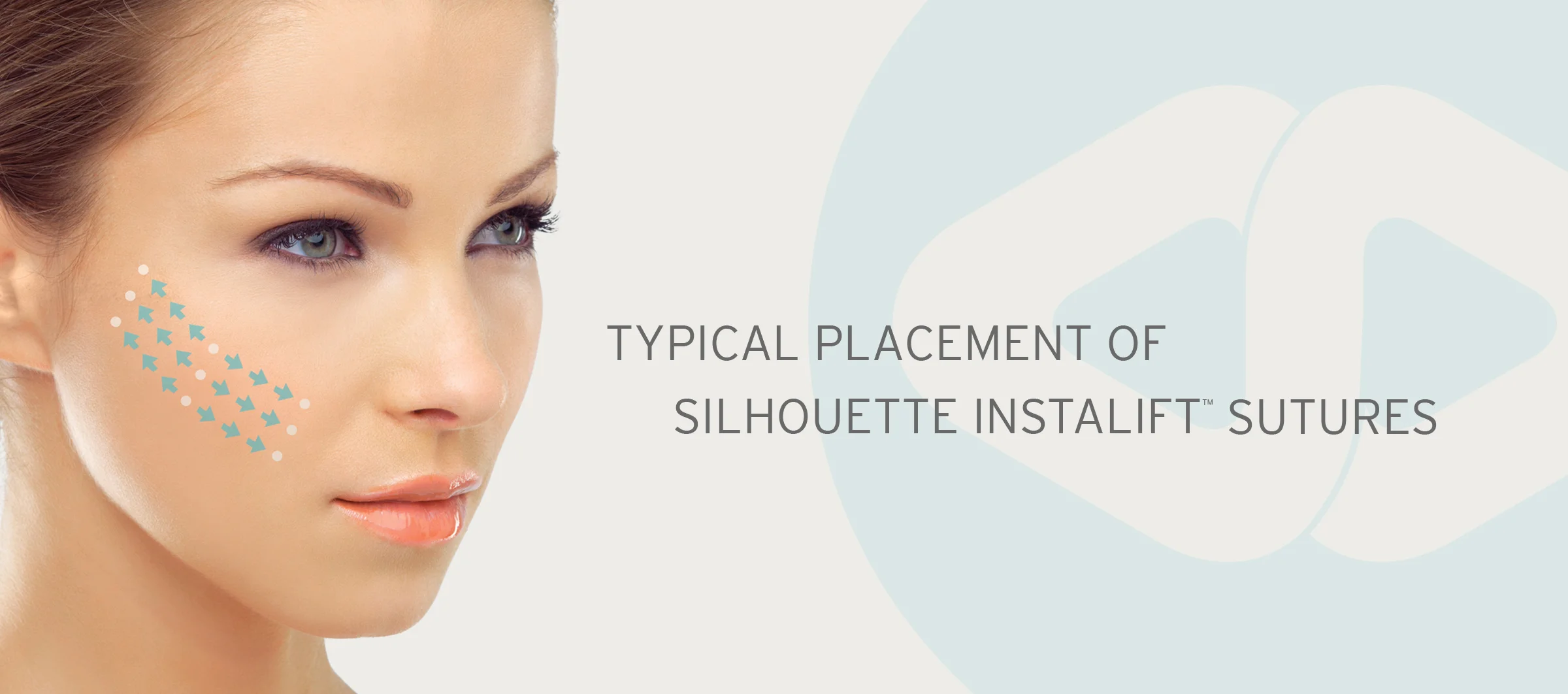 InstaLift_Banner_Sutures.jpg