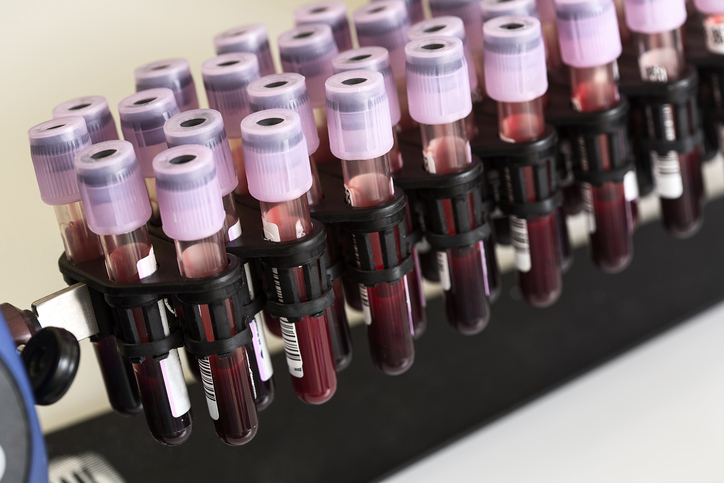 AncestryDNA’s Policies Under Scrutiny from Privacy Experts