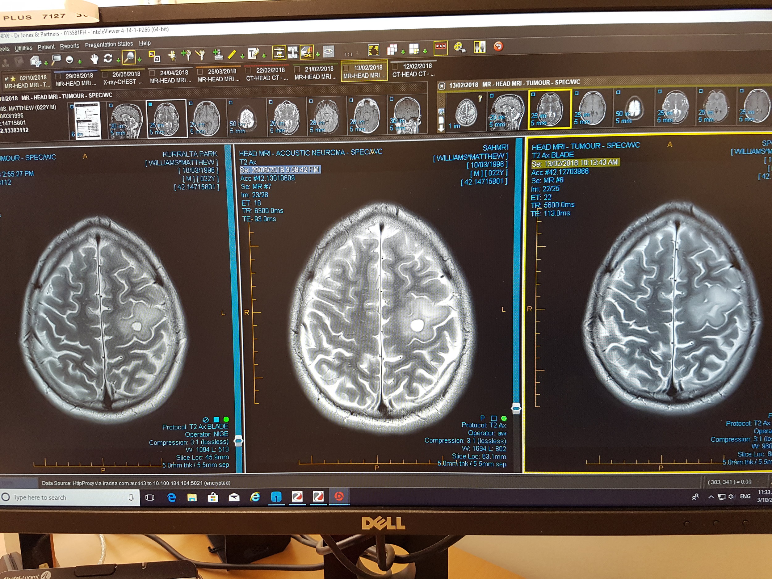 Brain scans.jpg