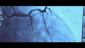 PACIFICO - UNSTOPPABLE HEART