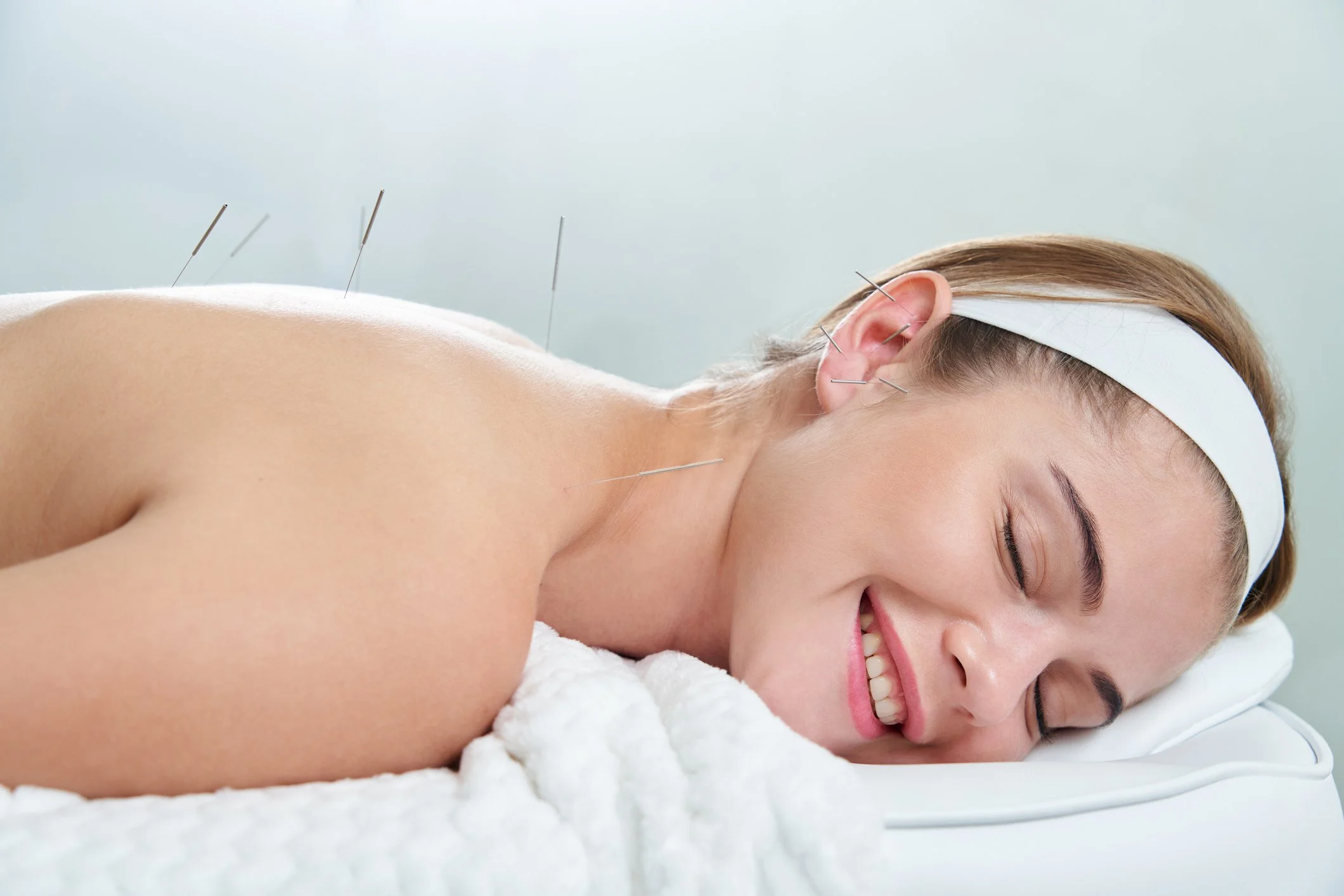 Patient receiving clinical acupuncture treatment for chronic back pain and structural alignment at Blue Sky Acupuncture in Woodbury NY