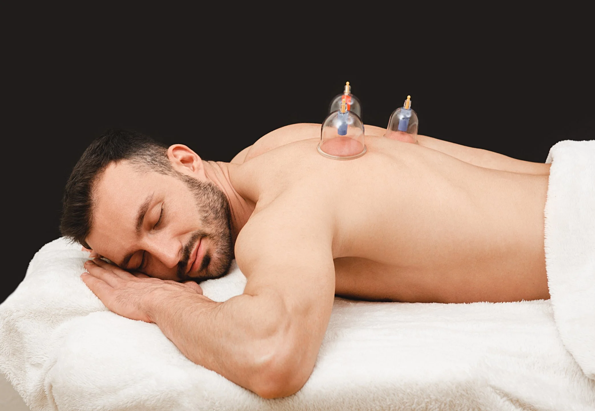 Myofascial cupping therapy for sports injury recovery and muscle pain relief in Woodbury NY