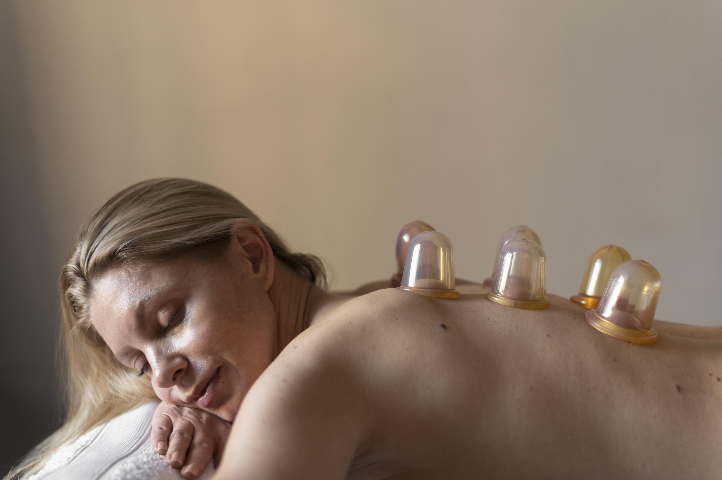 A woman receiving cupping therapy with several glass cups placed on her back during a massage session.