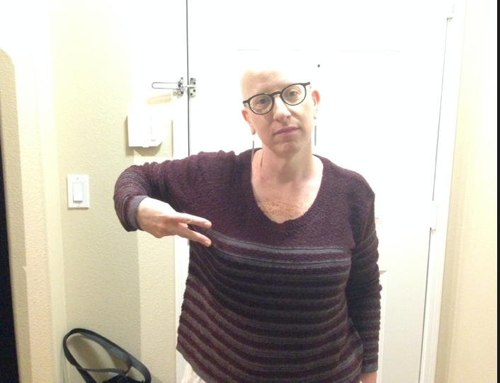 The date on this is 10-10-14 which means it was taken a couple of weeks after chemo ended. I have very few photos of my bald head! This is one of them. 
