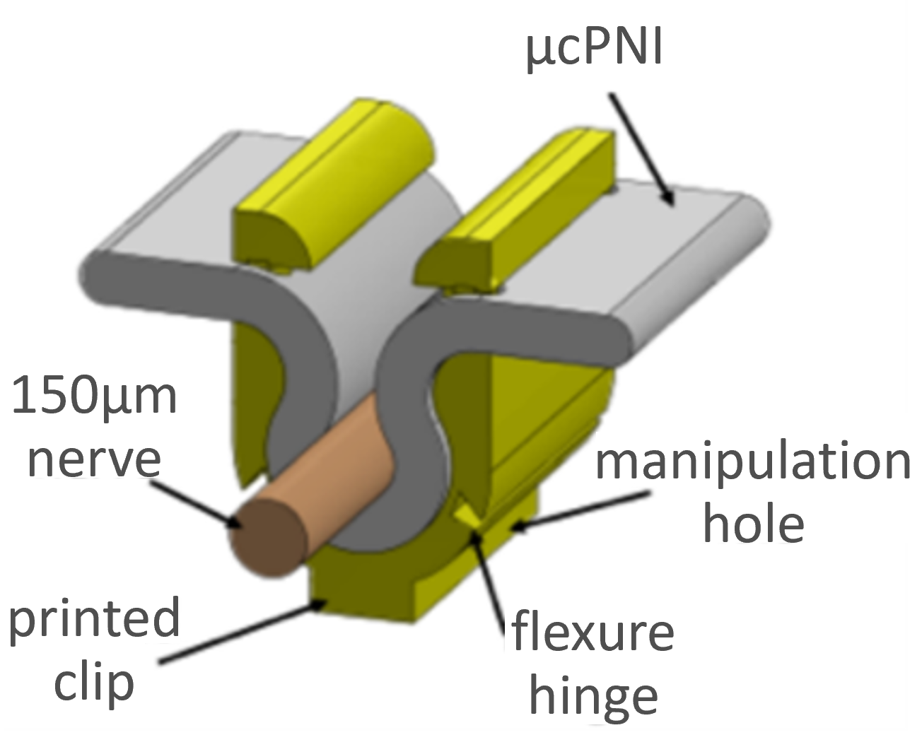 peripheral nerve interface wrapped around a nerve