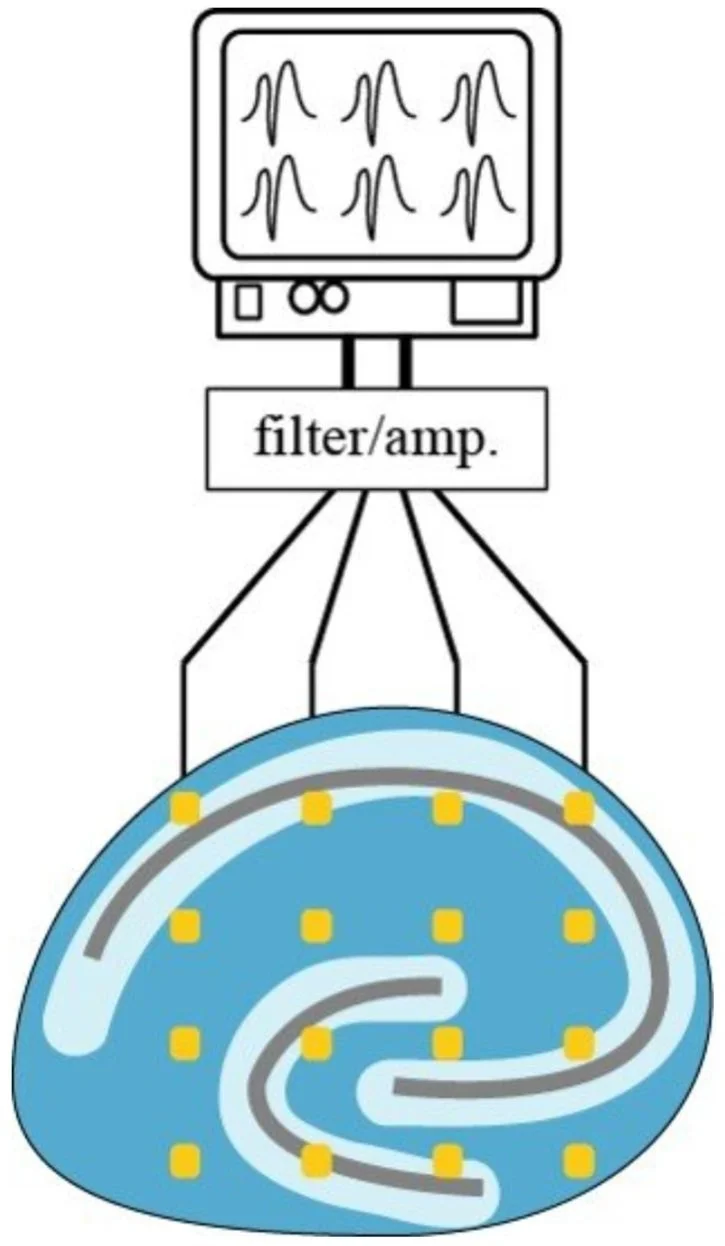 What is a Multielectrode Array (MEA)? | BMSEED